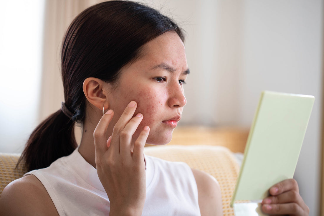 Why Natural Skincare Matters: What You’re Really Putting on Your Skin - Natú Botanicals MX